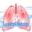 laserostop-paris-6